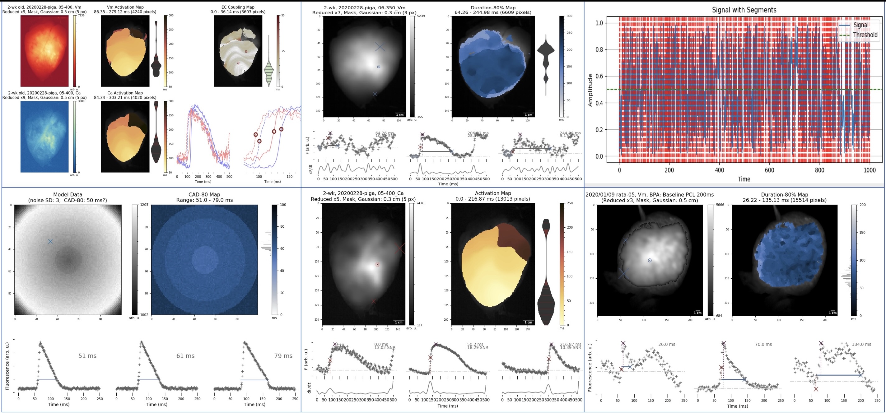 Cardiac Bioelectric Function Mapping